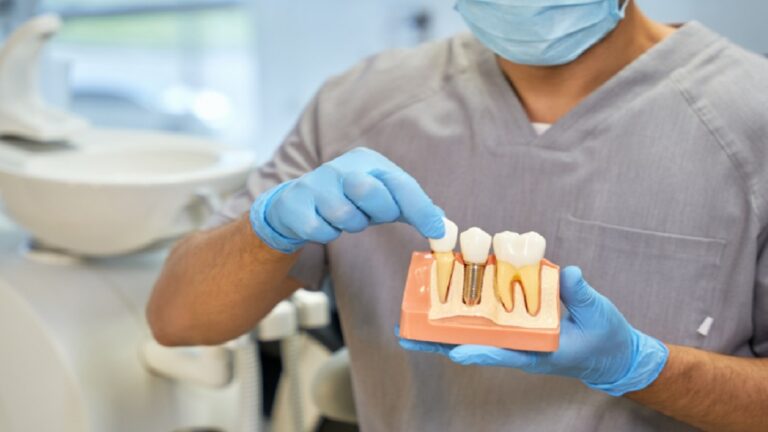 The Benefits of Opting for Dental Implants Over Other Treatments The Benefits of Opting for Dental Implants Over Other Treatments