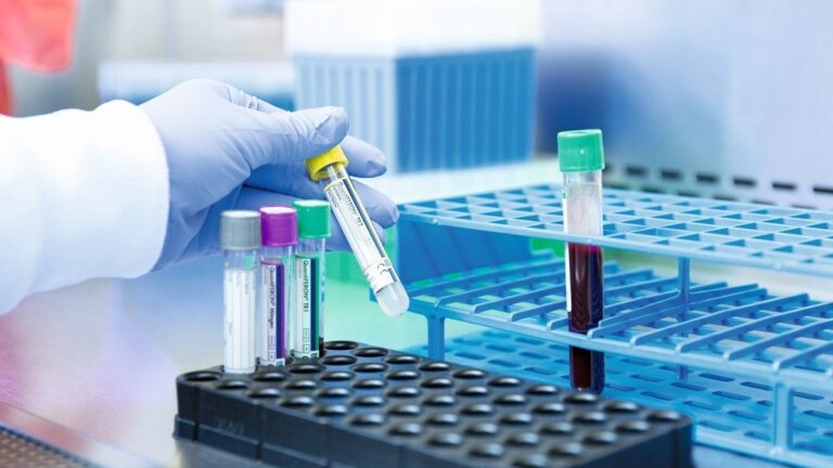 QIAGEN’s QuantiFERON-TB Gold Plus shows cost-effectiveness compared with TST in a newly published study in people with HIV