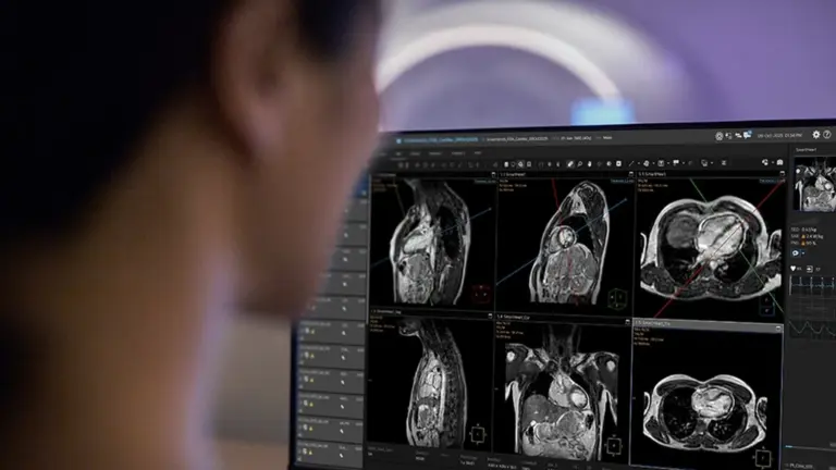 SmartHeart, the Cardiac MR Suite by Philips Gets Clearance