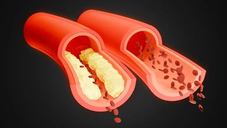 Peripheral Arterial Disease: Konstantinos Marmagkiolis Explains The Warning Signs and Endovascular Solutions