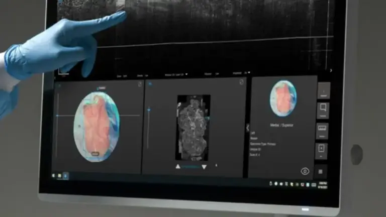 Intermountain Health Brings Perimeter’s Claire™ to the Operating Room, a Landmark in Breast Cancer Surgery Using AI